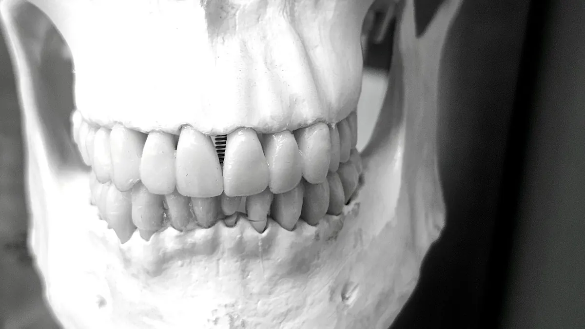 Cuidados después de un implante dental: la guía día a día del postoperatorio
