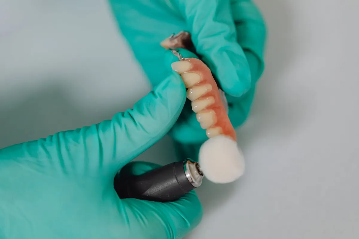 Implantes dentales y cigarro: qué pasa realmente si fumas